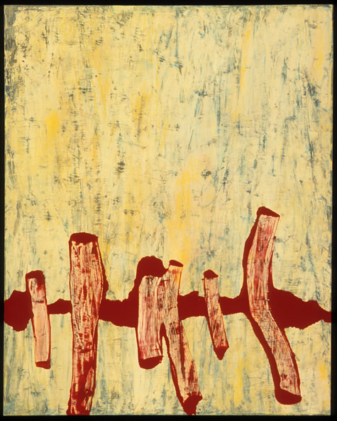 suture